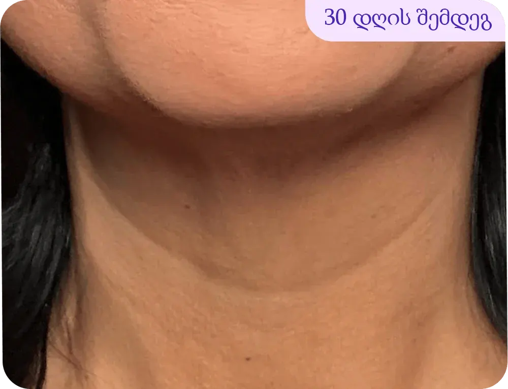 After 8 weeks