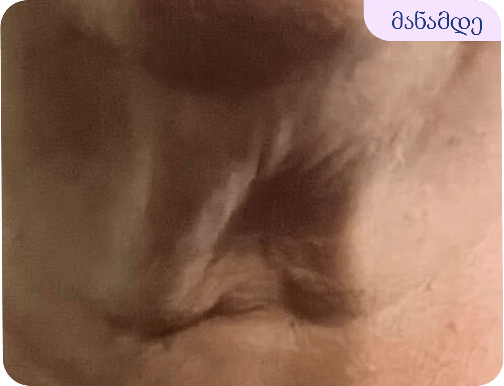 Before